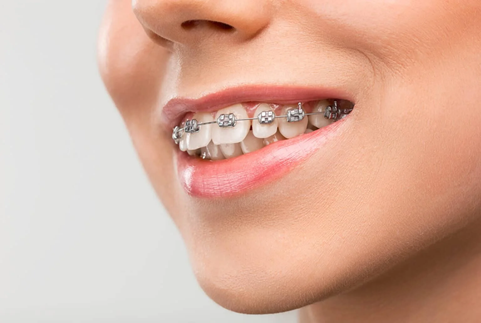 orthodontist in pune