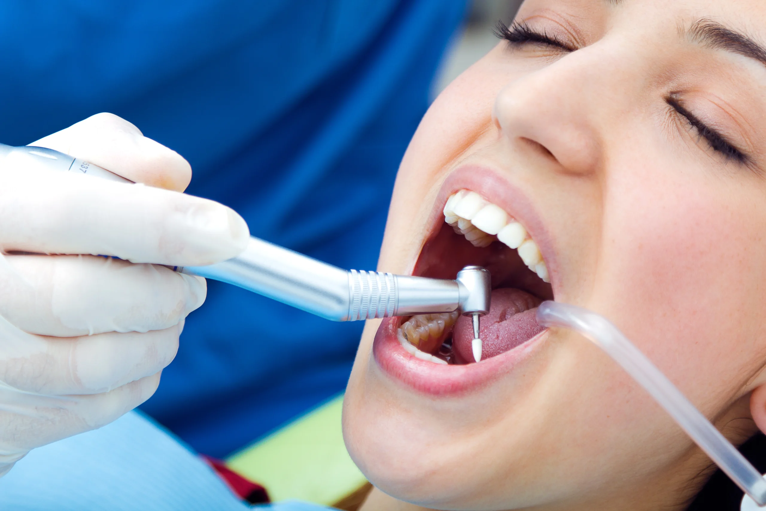 Teeth Cleaning in Pune